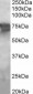 Goat Anti-PCK2 / PEPCK-M Antibody